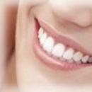 dentista milano rizza endodonzia